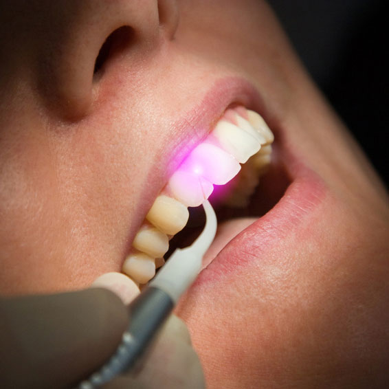 Schonender Eingriff mit dentaler Lasertechnik Schonender Eingriff mit dentaler Lasertechnik